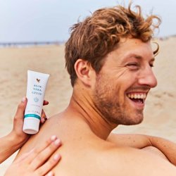 Aloe Vera Gelly til solskoldning